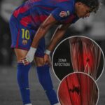 lesión bíceps femoral lamine yamal
